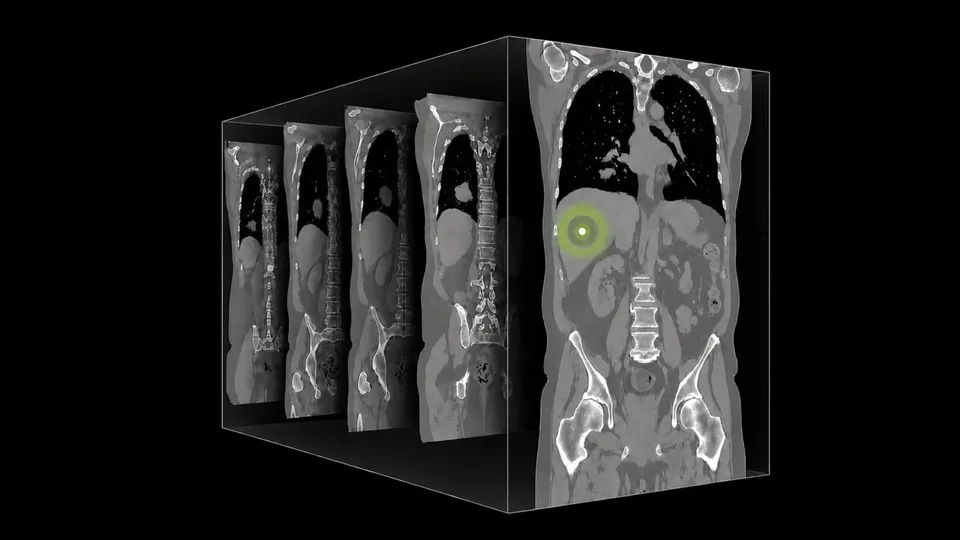 Three-dimensional visualization of a CT scan volume showing multiple slice planes and a highlighted area in the abdomen.